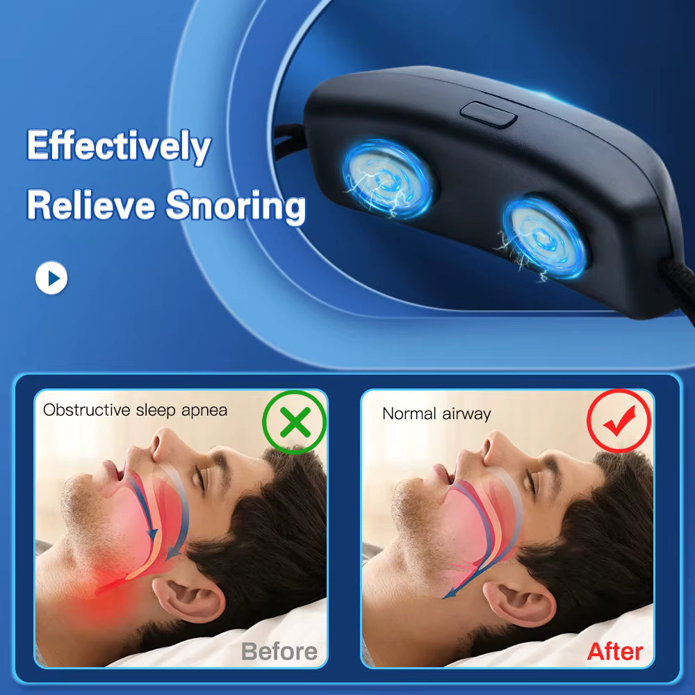 Device to relieve snoring